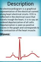 Electrocardiogram