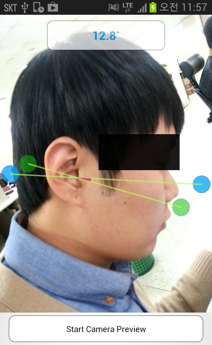 Smart Facebow