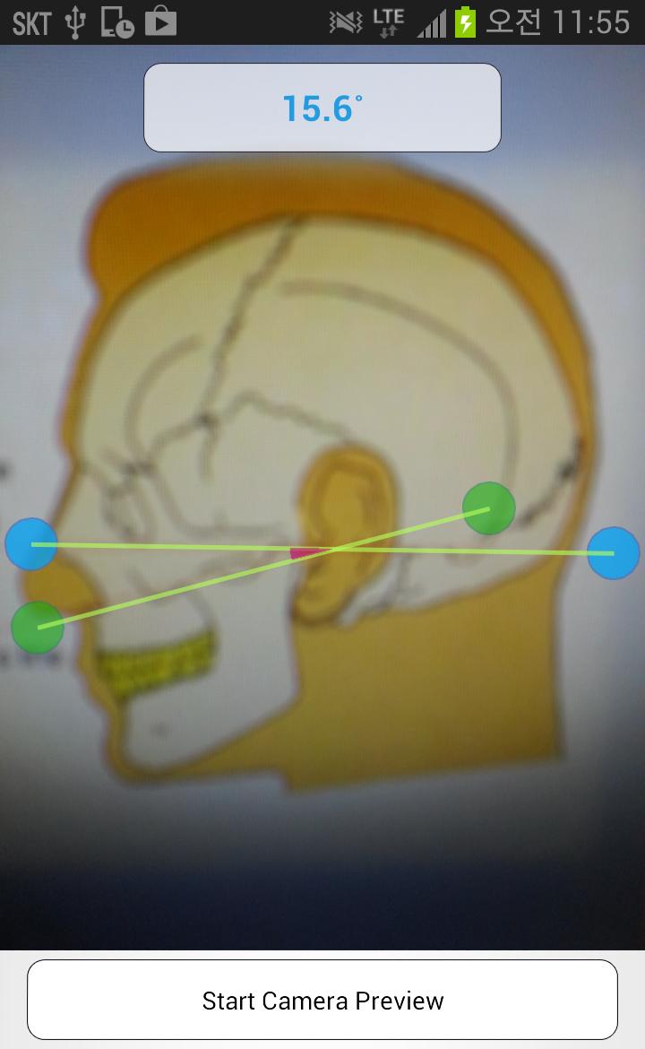 Smart Facebow