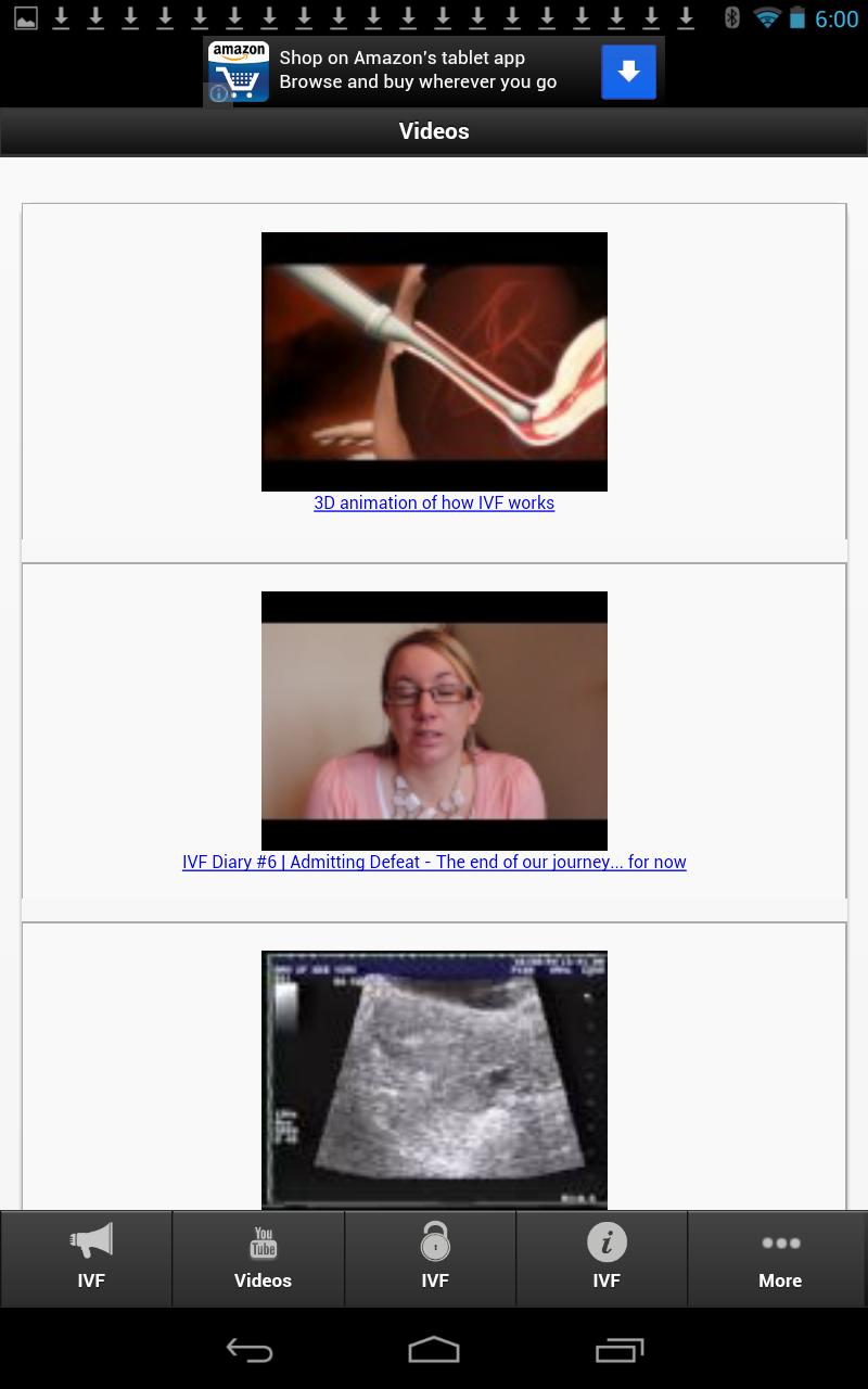 IVF